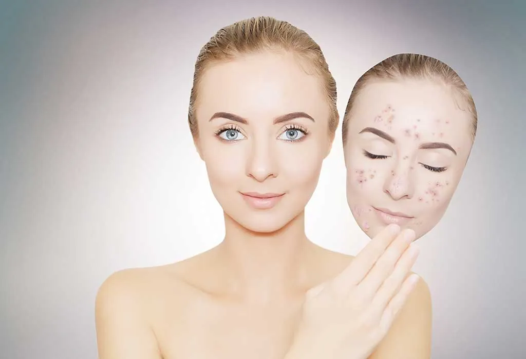 Dark Spots