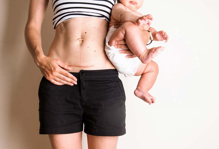 'Bikini Cut' and 'Formula Mom' : My Child, My Rules