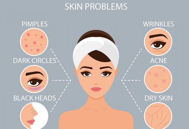 Remedies For Skin Infection On Face