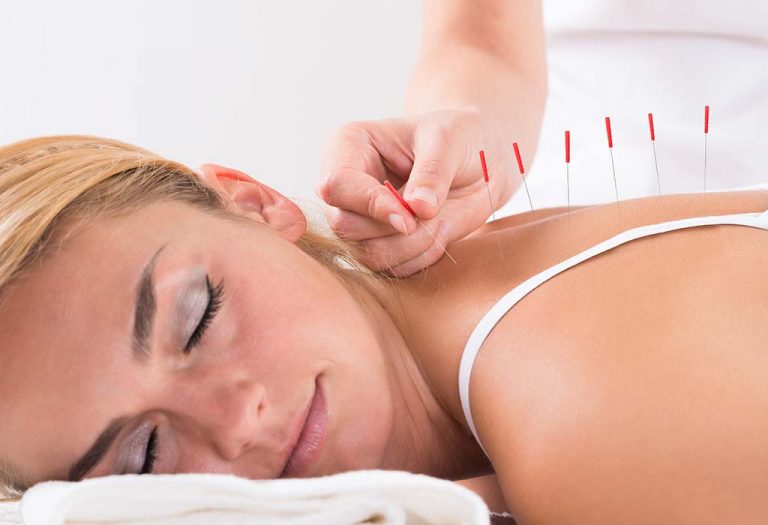 Trying Acupuncture for Weight Loss? - Here's The Fact Behind It