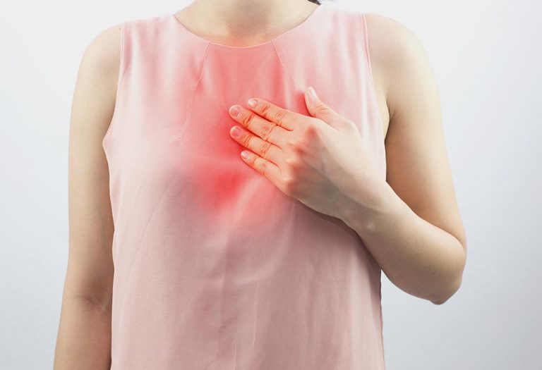 Foods to Avoid During Acid Reflux or Heartburn