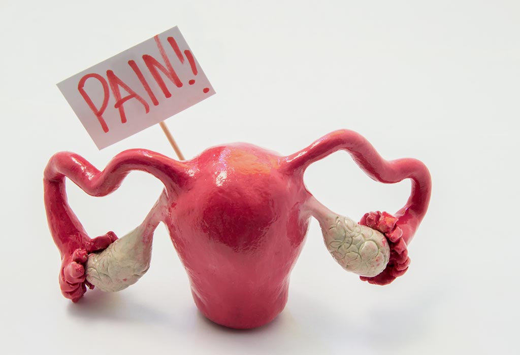 Cyst Twist or Torsion Ovarian Pain