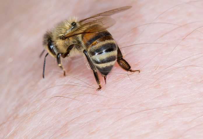 Home Remedies for Bee Stings that Will Help You Combat Its Effects