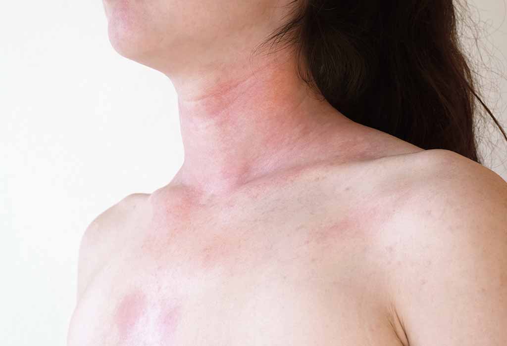 What is Skin Allergy