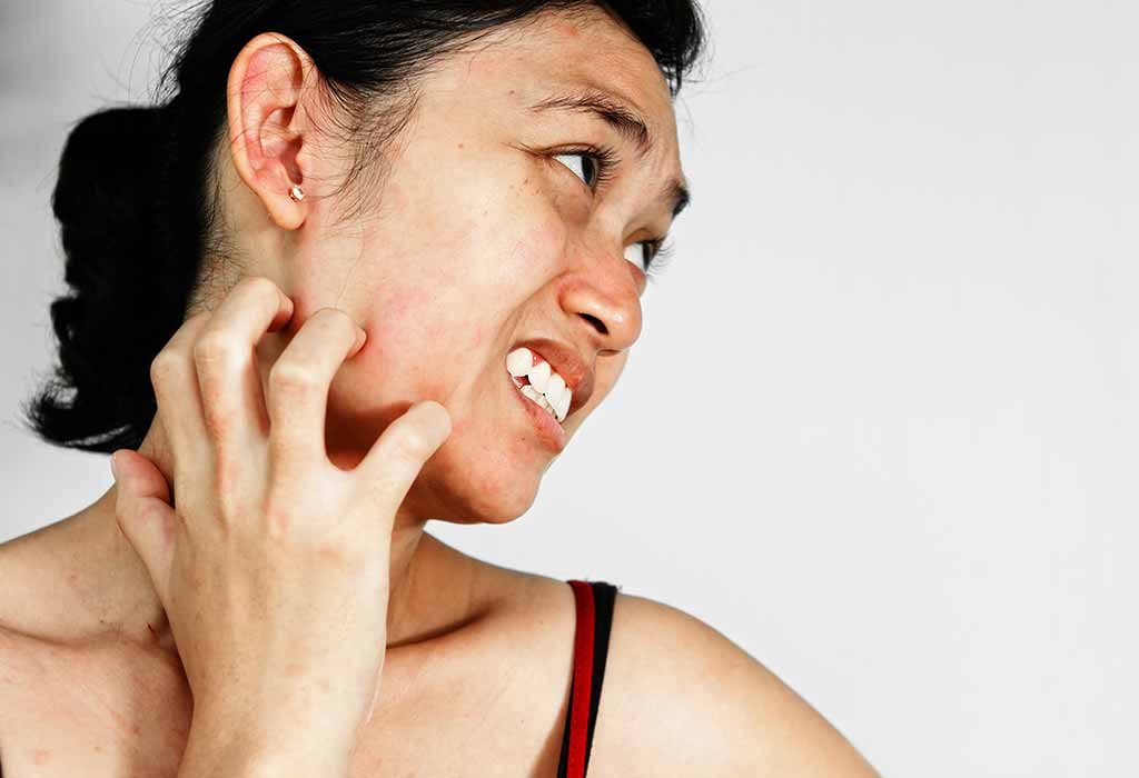 10 Effective Home Remedies For Skin Allergies