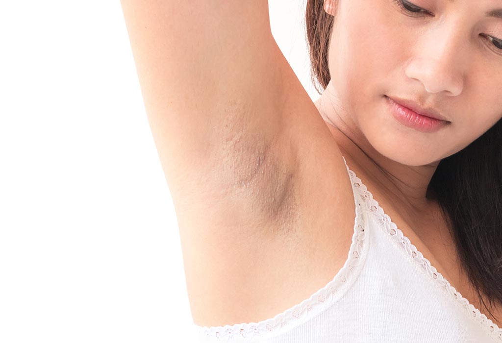 10 Simple Effective Home Remedies For Dark Underarms