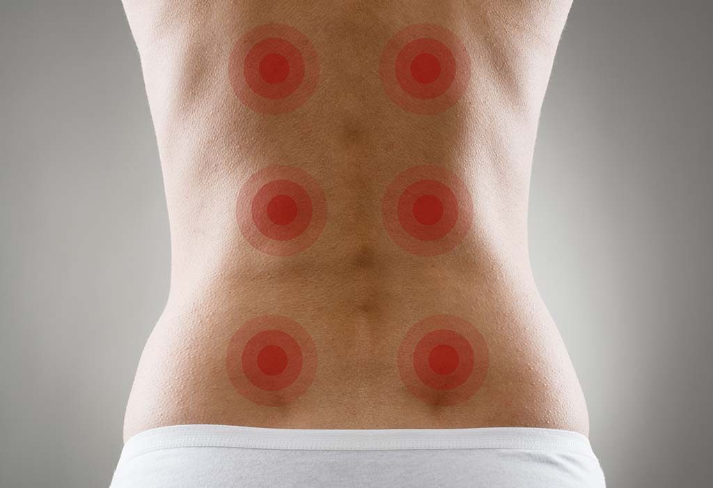 Acupressure Points for Back Pain – Know How to Use Them for Best Results
