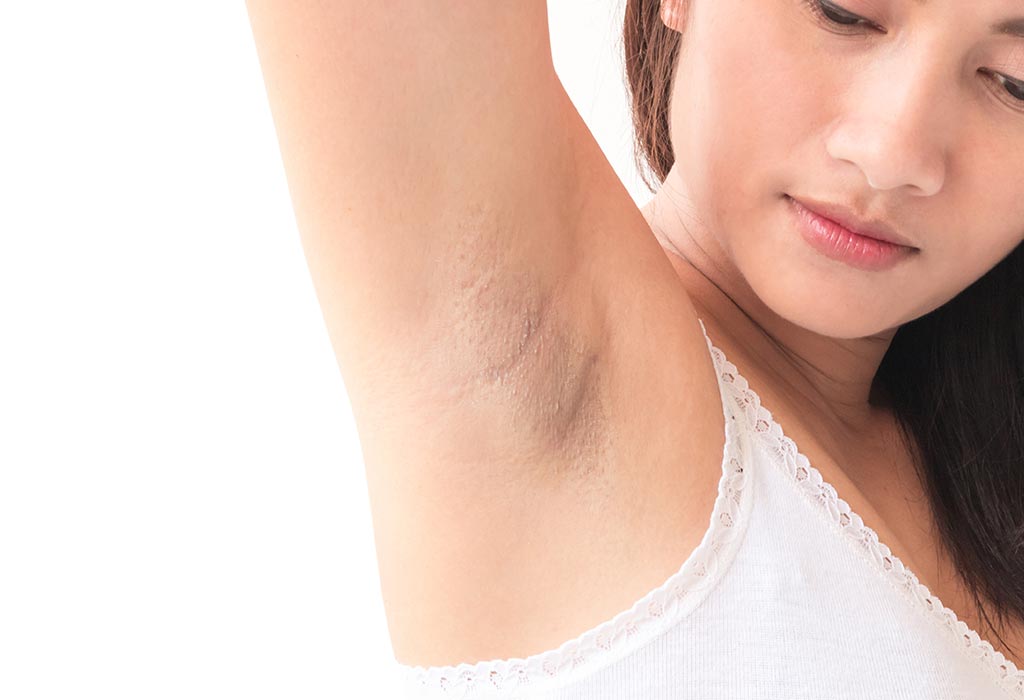 How To Lighten Your Underarms Naturally Lighten With Lemon Baking Soda