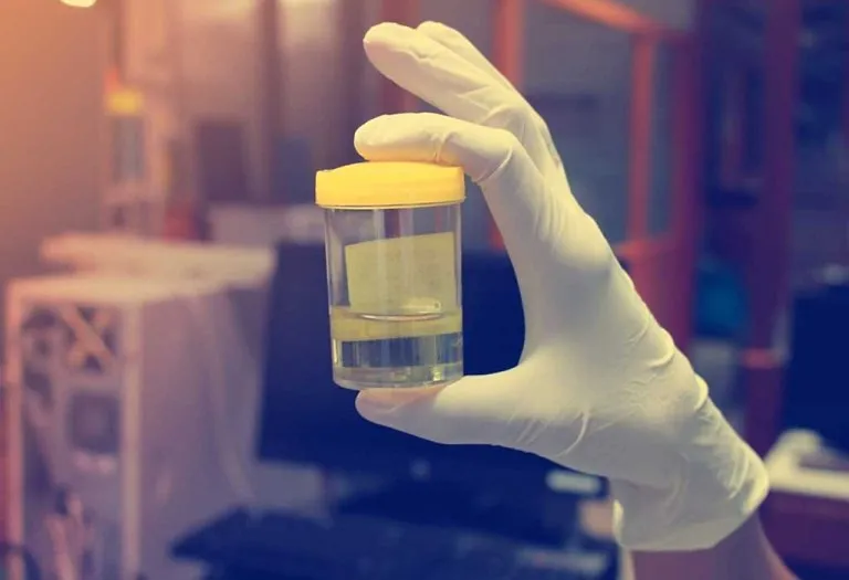 Urine Test and Urine Culture During Pregnancy - Importance, Procedure, & Results