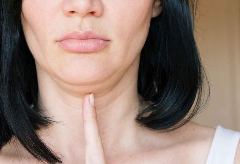 15 Natural Ways to Tighten Your Sagging Skin