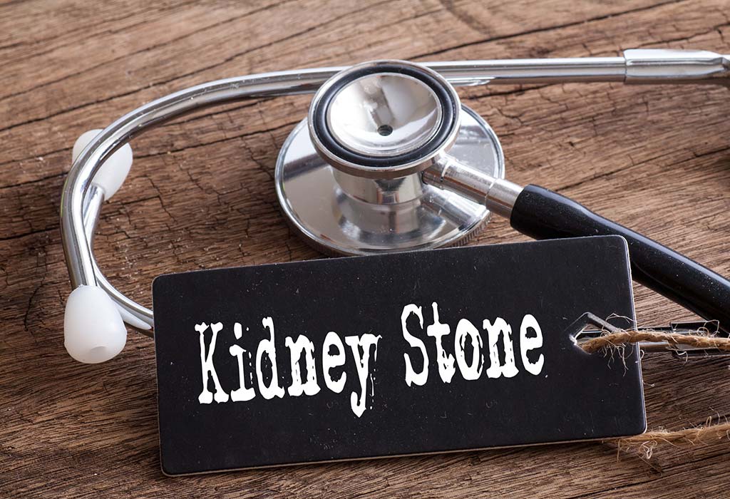 Kidney stones