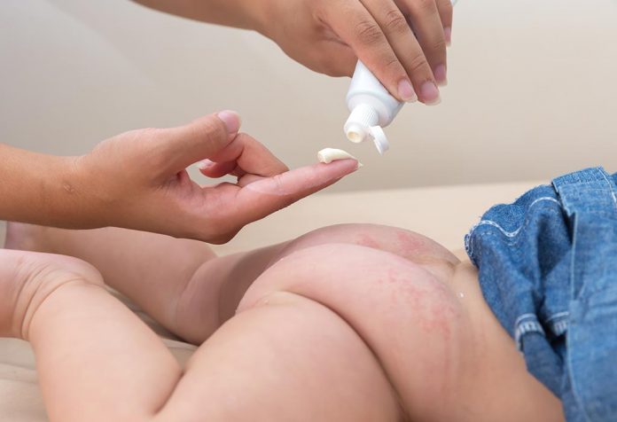 10 Best Diaper Rash Creams for Babies