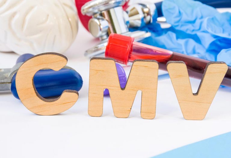 Cytomegalovirus (CMV) in Babies