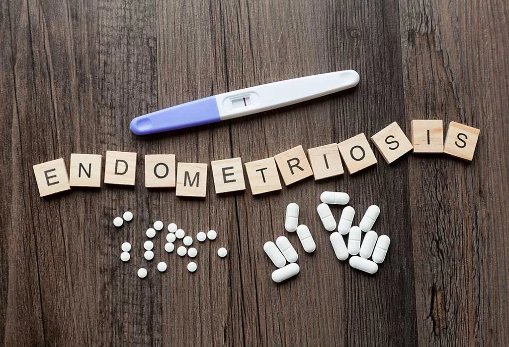 Ivf For Women With Endometriosis Does It Actually Helps 3541