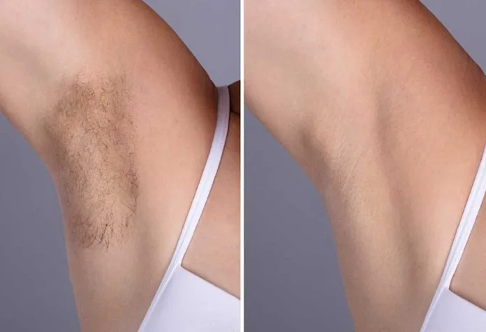 how to remove underarm hair easy tricks and home remedies