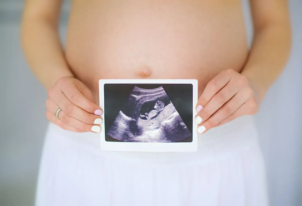 A woman holding an ultrasound