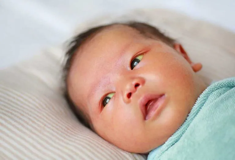 Jaundice in Babies - Occurrence and Treatment (Personal Experience)