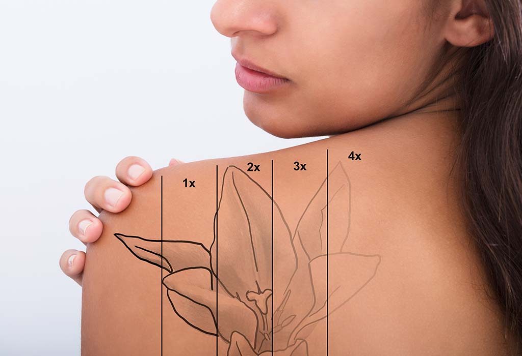 How to Remove Permanent Tattoo 10 Effective Ways to Try