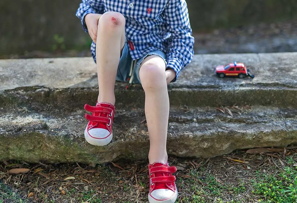 Remedies for cuts and bruises