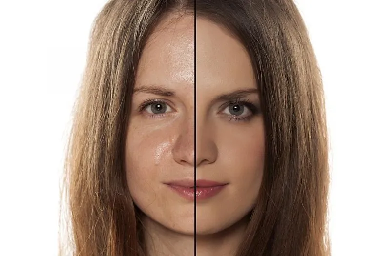 Home Remedies for Oily Skin