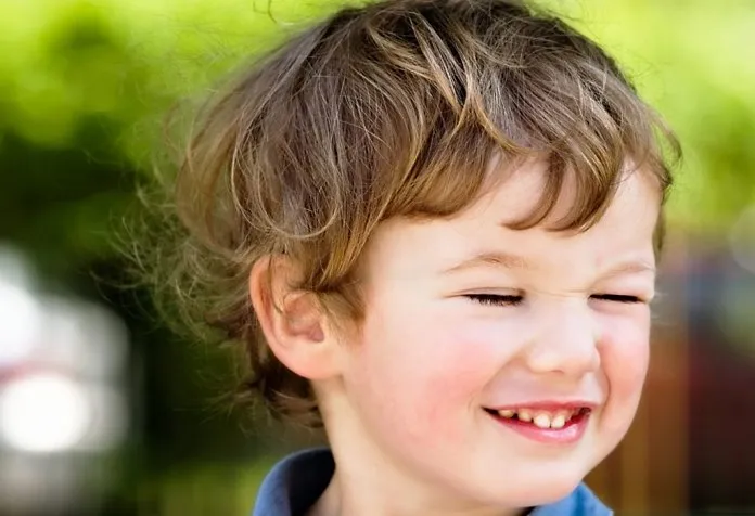 Excessive Blinking Of Eyes In Kids Reasons Remedies