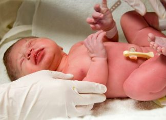 नवजात शिशु का अपगर स्कोर l Navjat Shishu Ka Apgar Score नवजात शिशु का अपगर स्कोर l Navjat Shishu Ka Apgar Score