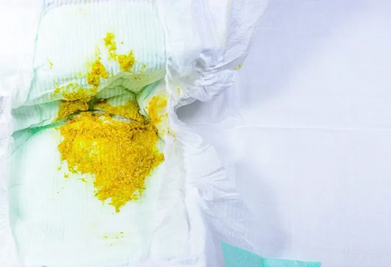 Baby Diarrhea – Causes, Treatment and Prevention