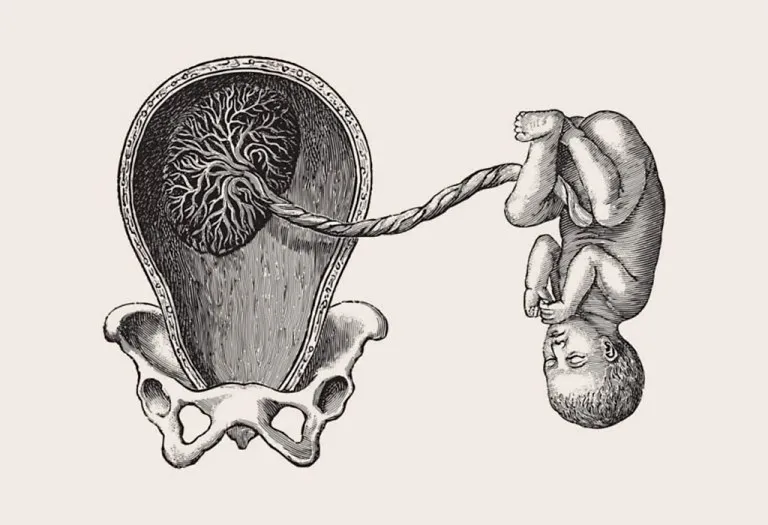 Placenta Previa – Symptoms, Causes, Risks & Treatment