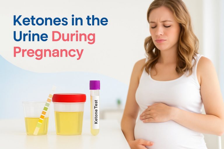 Ketones in the Urine During Pregnancy - Causes,Treatment, and Prevention