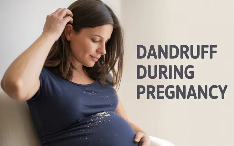 Dandruff During Pregnancy - Causes and Remedies
