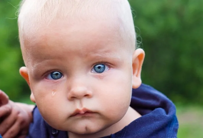 Watery Eyes in Babies - Causes, Risks and Prevention