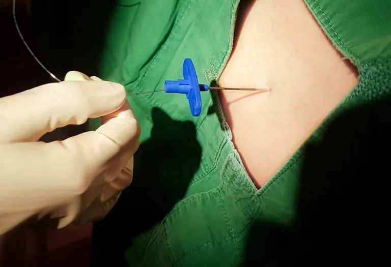 What is Painless Delivery? - Understand it From a Gynaecologist