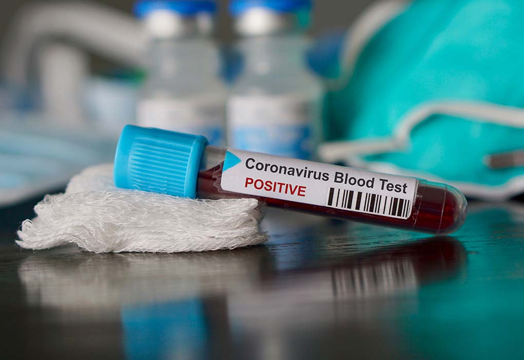 Coronavirus test positive