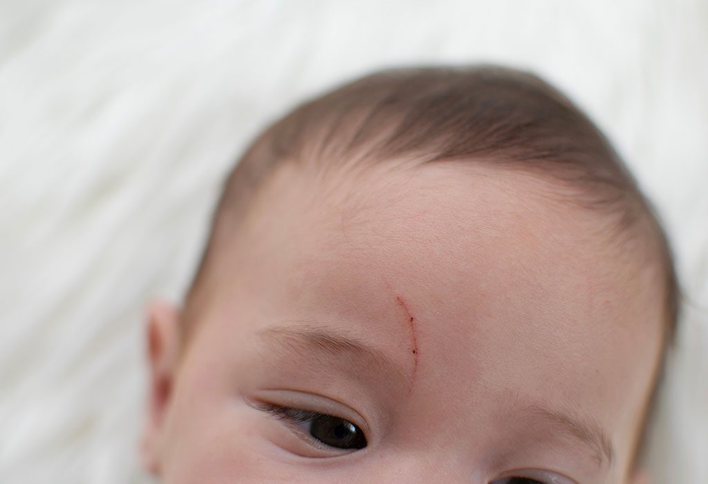 Baby Keeps Scratching Face Reasons Prevention Tips