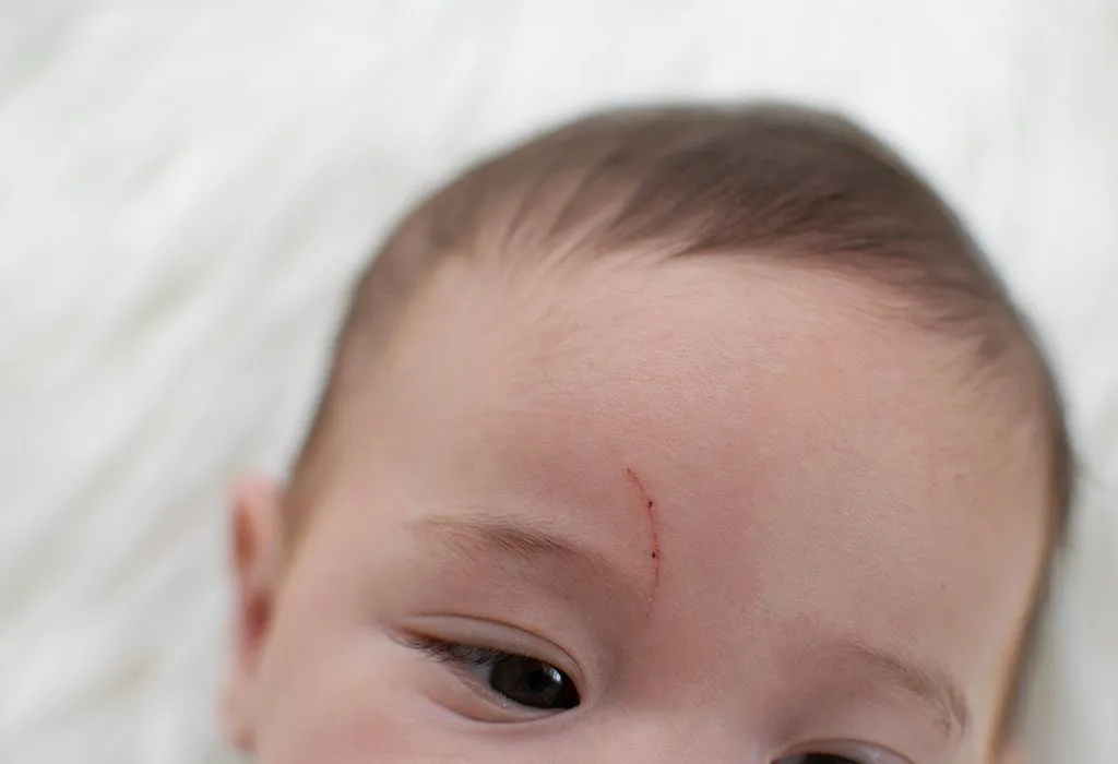 Baby Keeps Scratching Face - Reasons & Prevention Tips