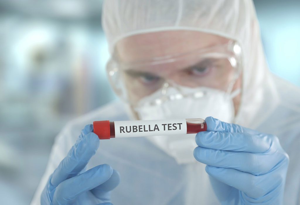 Rubella test