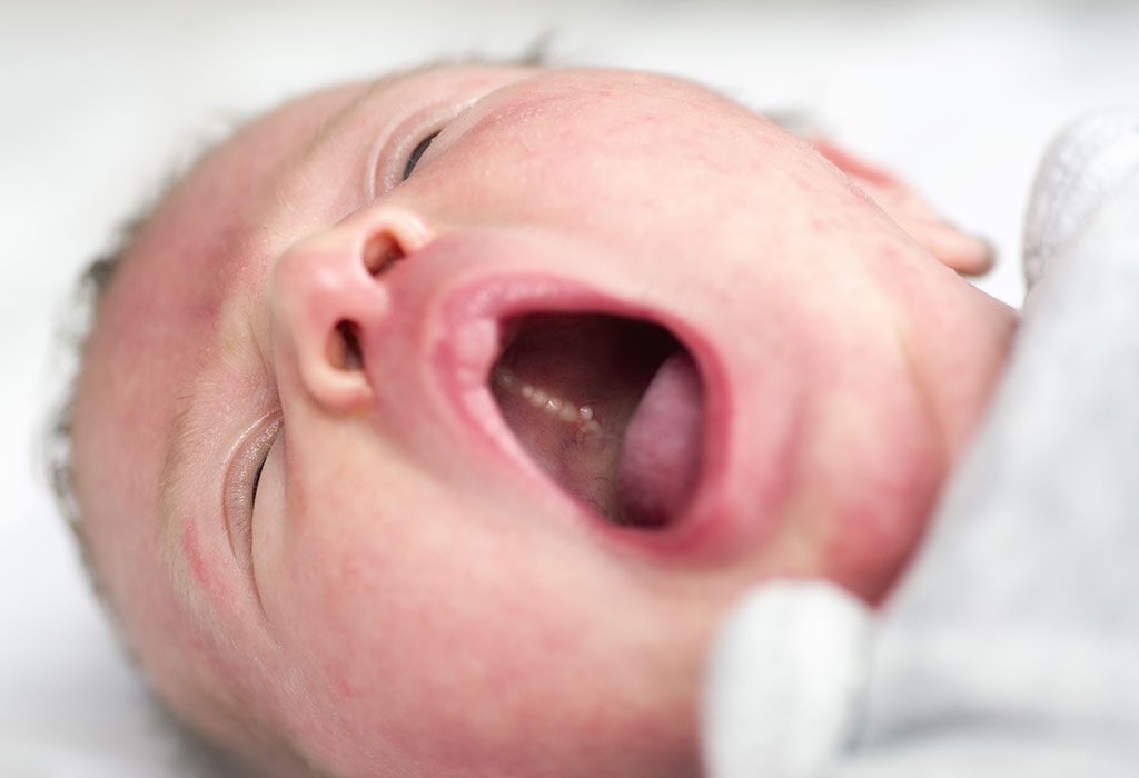 newborn baby gums