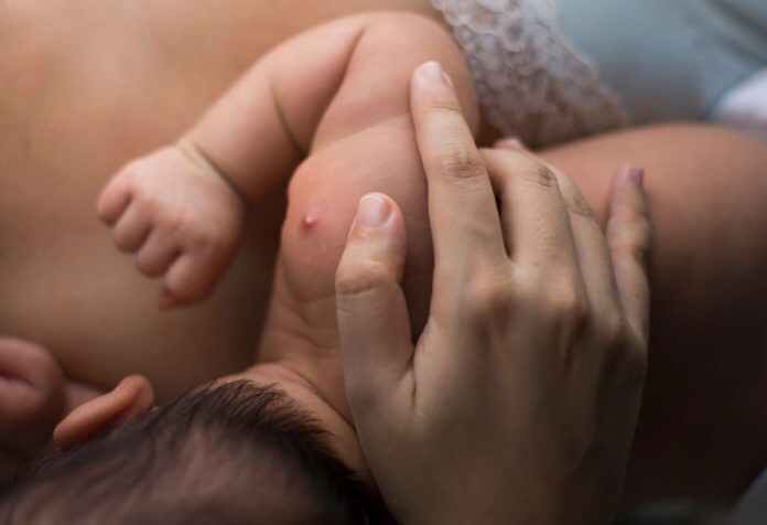 बाळाच्या त्वचेवरील फोडांवर कसे उपचार करावेत?