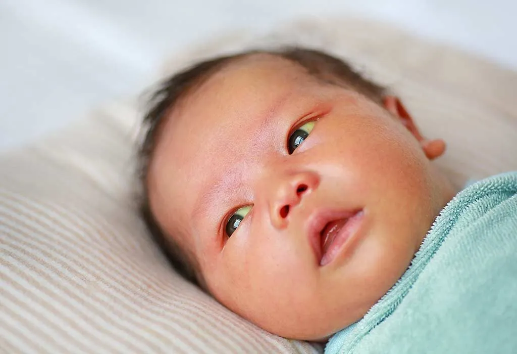 Yellow eyes in babies