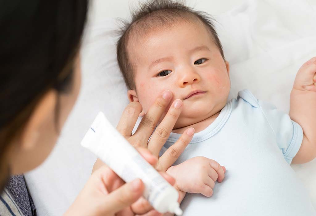 A mother applying cream on her baby's face