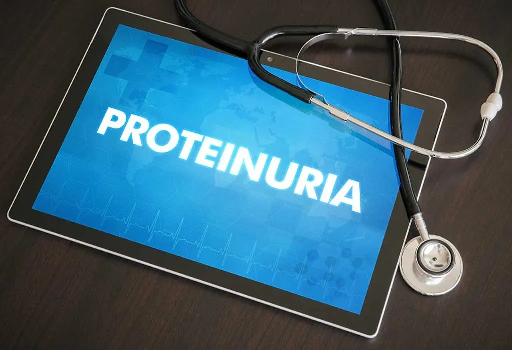 Proteinuria, a Cause of Eclamspia During Pregnancy