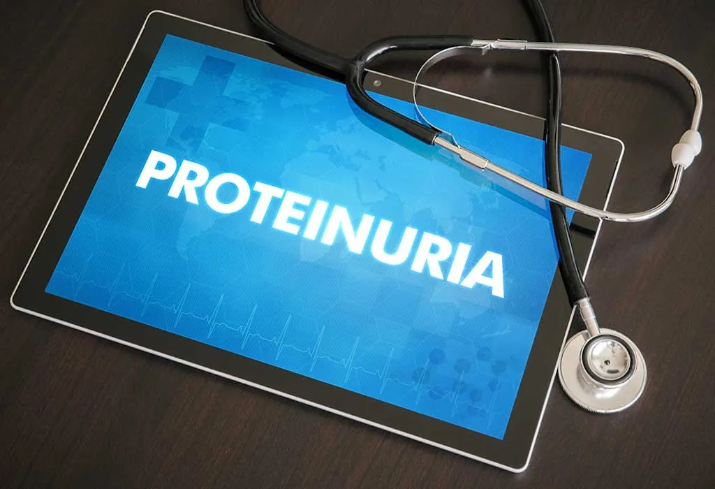 Proteinuria, a Cause of Eclamspia During Pregnancy