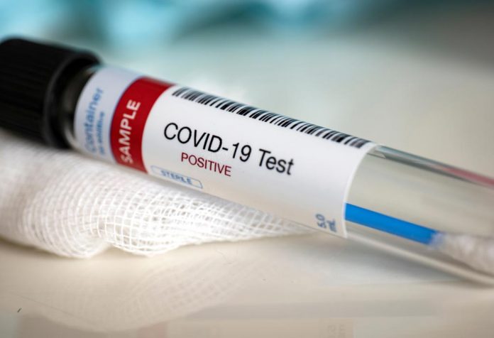 We Can Fight COVID-19 Coronavirus But We Can't Fight With People's Mentality