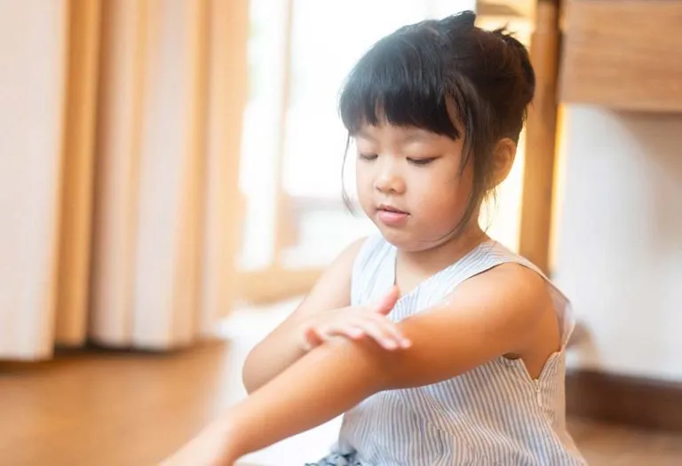 8 Best Mosquito Repellent Creams and Gels