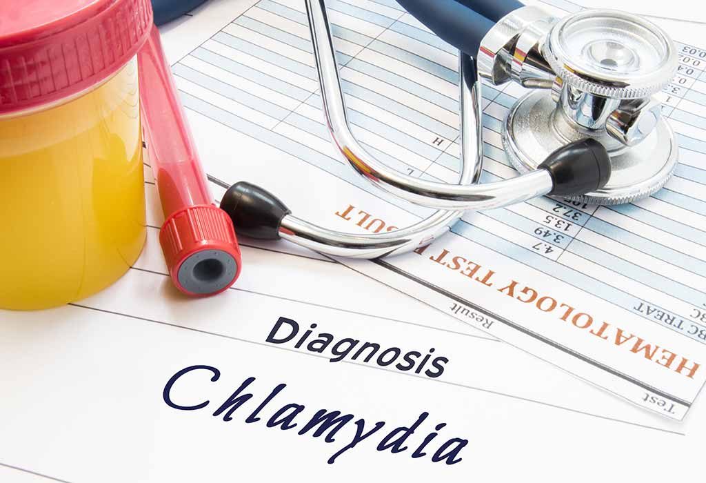 chlamydia diagnosis