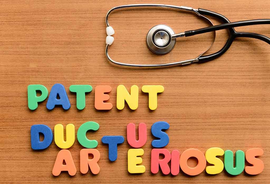 Patent Ductus Arteriosus – Causes, Symptoms, and Treatment