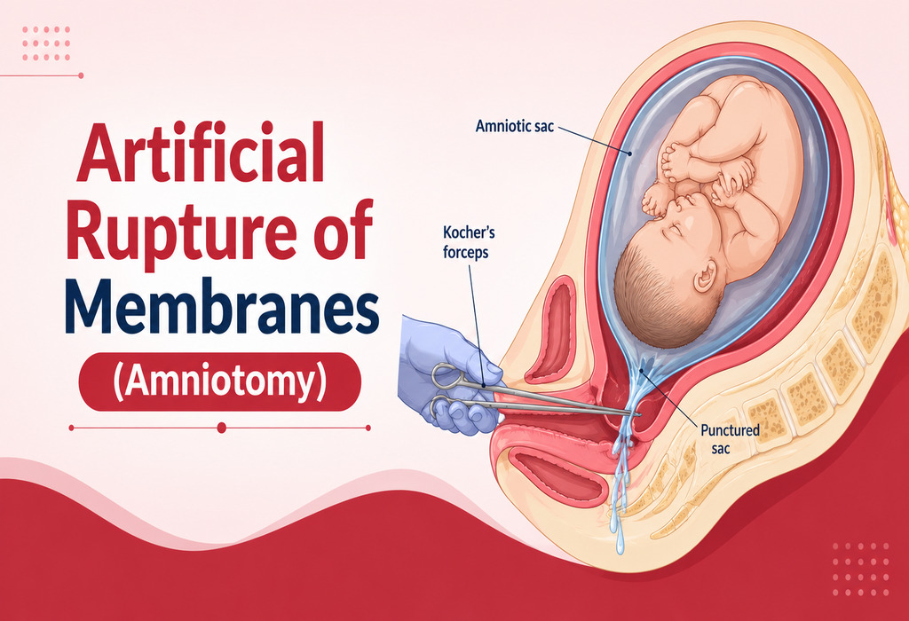 Artificial Rupture of Membranes (Amniotomy) in Pregnancy