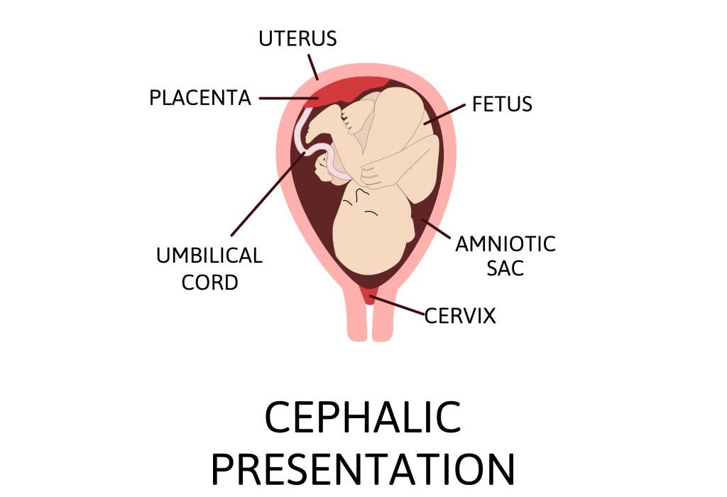 cephalic presentation in scan means