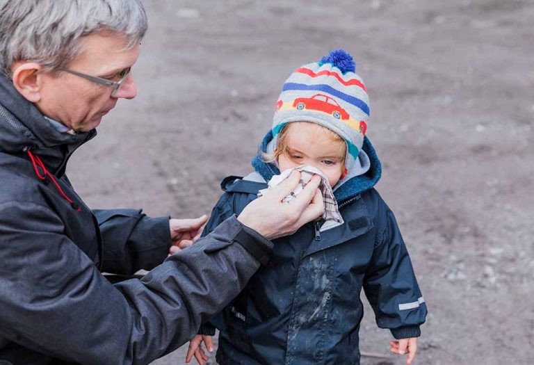 Sinusitis (Sinus Infection) in Babies Causes, Symptoms & Treatment