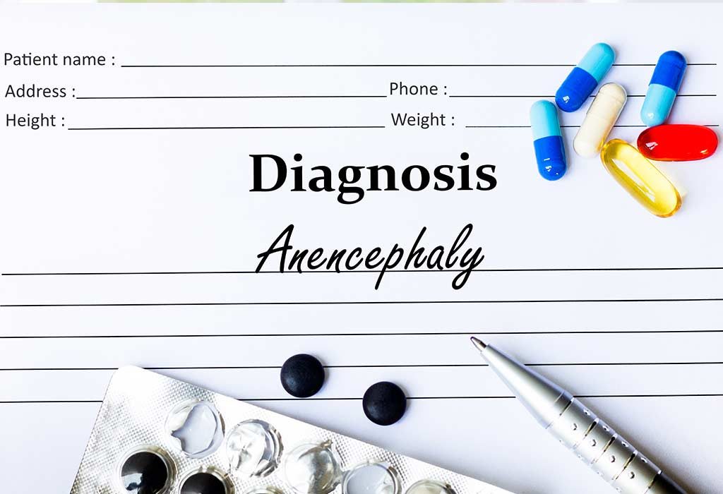 Anencephaly in Babies – Causes, Diagnosis, and Treatment